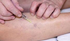 Kojų venų operacijos: kišenė gali nukentėti