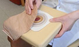 Stomų priežiūra - patogi ir saugi