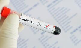 Lietuvoje pradėta dažniau sirgti sifiliu