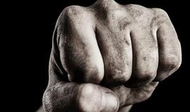 Norvegijoje sumuštas vyras gydosi Kretingos ligoninėje