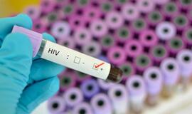 AIDS dienai paminėti - ir protų mūšis