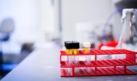 Geoterminiai vandenys atveria naujas perspektyvas sveikatos turizmui