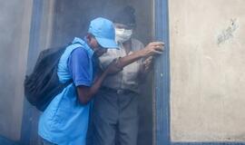Zikos virusas gali sukelti mikrocefalijos epidemiją