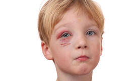 Vaiko teisių specialistai stiprina bendradarbiavimą su medikais