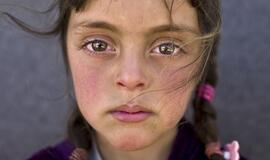 UNICEF „Metų nuotraukoje“ - liūdnos vaikystės veidas