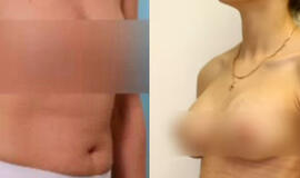 Išaiškinti trys vyrai, pasisavinę klinikos „Grožio chirurgija“ duomenis