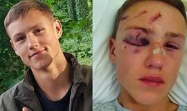 Darbas statybose Mindaugui baigėsi tragiškai: liko be akies