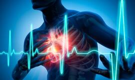 Kardiologės patarimai, kaip pagerinti kraujotaką ir išvengti infarkto