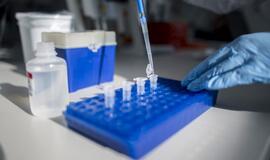 Mokslininkai: koronavirusai ant paviršių išlieka iki devynių dienų