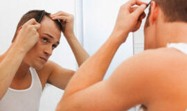 Plaukų persodinimui dažniau ryžtasi vyrai: dermatovenerologė atskleidė priežastis