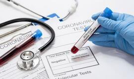 Koronavirusu šiuo metu serga 135 medikai