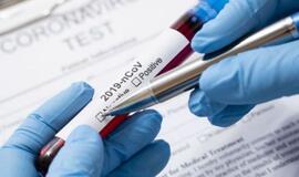 Nemenčinės įmonėje susirgo 10 žmonių