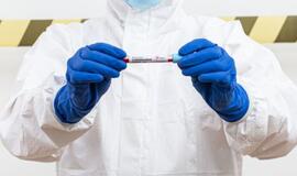 Lietuvoje nuo COVID-19 mirė dar vienas žmogus