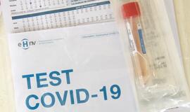 Žmonės aktyviai registravosi koronaviruso testui