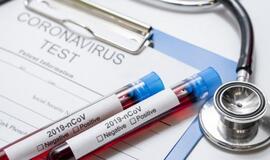 Pradėtas tyrimas dėl greitųjų COVID-19 testų pirkimo