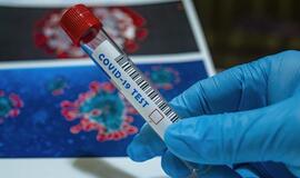 JAV per parą nustatyta daugiau kaip 55 tūkst. COVID-19 atvejų