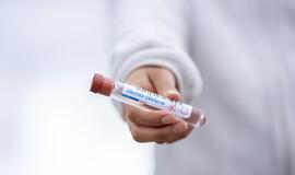 Mokamus koronaviruso testus galima atlikti 5 laboratorijose