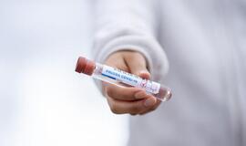 Klaipėdiečiams – galimybė pasitikrinti dėl COVID – 19