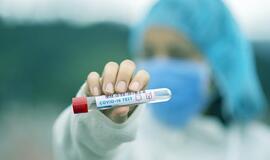 Patvirtinti 29 koronavirusinės infekcijos atvejai