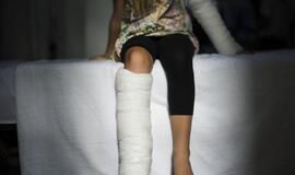 Vaikas susižeidė žaisdamas. Kodėl tėvus aplanko vaiko teisių apsaugos specialistas?