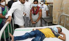 Indijoje hospitalizuota daugiau kaip 500 žmonių, susirgusių nežinoma liga