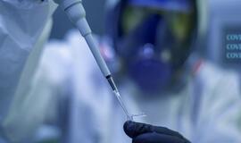 Mokslininkai nustatė genų, lemiančių didesnę tikimybę susirgti sunkios formos COVID-19