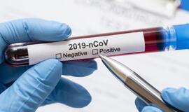 SAM: kada COVID-19 gali būti diagnozuotas be testo