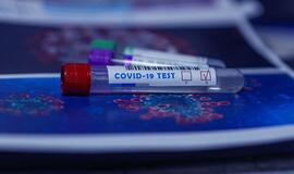 Verslo atstovai prašo valstybės paramos darbuotojų koronaviruso tyrimams