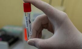 Prokuratūra prašo iš bendrovių priteisti per 4 mln. eurų už greituosius COVID-19 testus