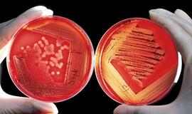 Senos bakterijos pasirodė esančios atsparios šiuolaikiniams vaistams