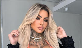 27 metų nuomonės formuotoja mirė po plastinės operacijos