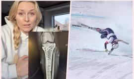 Lindsey Vonn sveiksta po siaubingo kritimo Milano-Kortinos žaidynėse