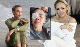 Po rimtos akies operacijos „Man-go“ vokalistė Rima Petrauskytė neslėpė šoko