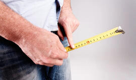 Vyrai didina savo „pasididžiavimą“ nauja procedūra