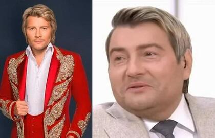 Nikolajui Baskovui dėl ligos sunku vaikščioti