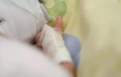 Aiškėja, dėl ko buvo sumušta dvejų metukų mergaitė