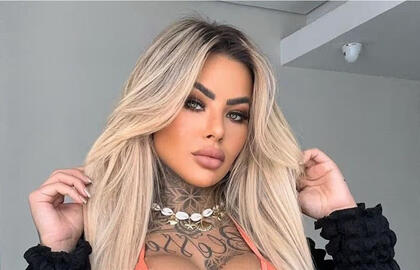 27 metų nuomonės formuotoja mirė po plastinės operacijos