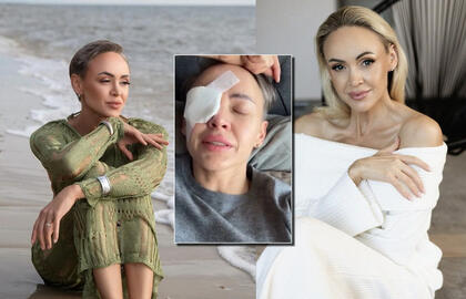 Po rimtos akies operacijos „Man-go“ vokalistė Rima Petrauskytė neslėpė šoko