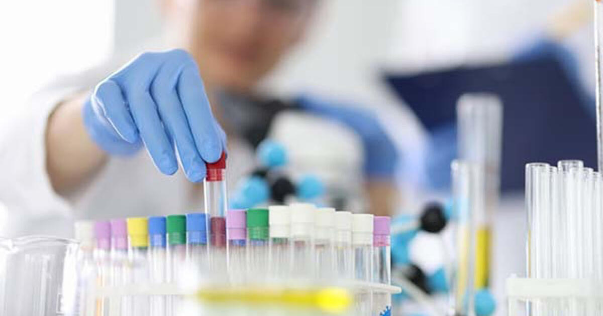 Naujas šlapimo tyrimas gali padėti kai kuriems vyrams, kurių PSA yra ...