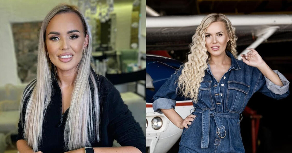 Per plauką nuo tragedijos: Donatai Gutauskienei-Laisvai per filmavimą užsidegė plaukai