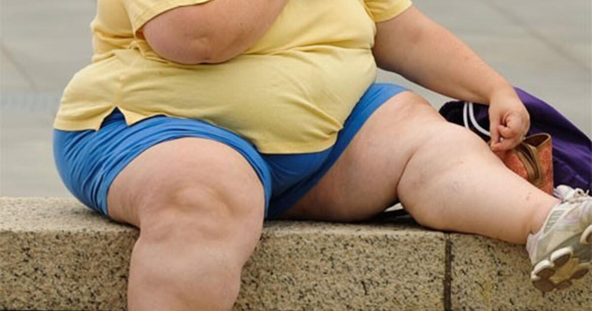 Nutukimas – ankstyva, bet iki šiol dažnai ignoruota širdies ligų rizika: ką daryti?