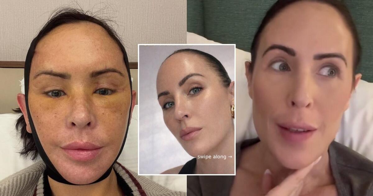 Siekis atjaunėti Turkijoje pakurstė negailestingus komentarus: atrodai keliais metais vyresnė