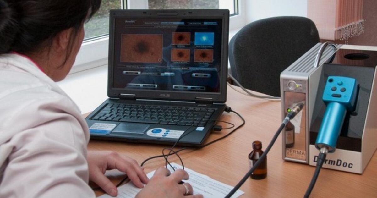 Kaip atpažinti melanomą: gydytojai įvardijo požymius, kurių negalima ignoruoti