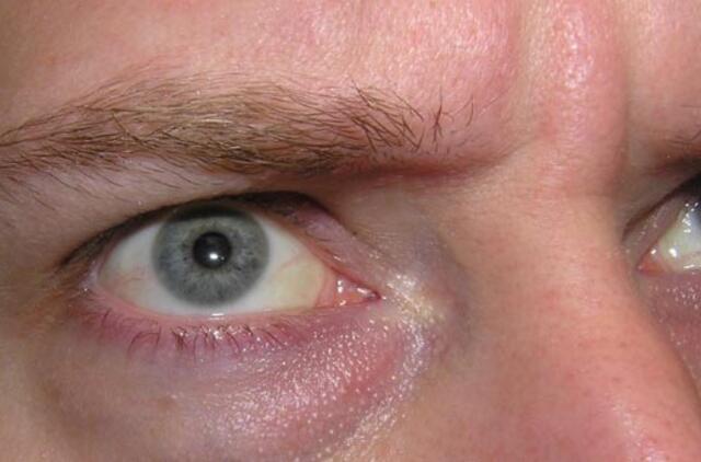 Kaip valdyti savo pyktį