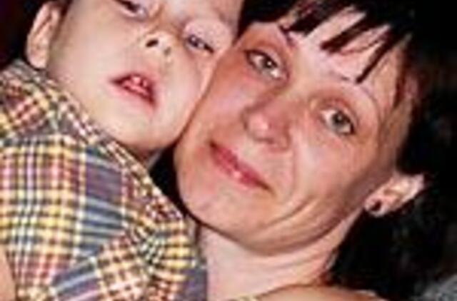 Lukui, sergančiam reta genetine liga, reikalinga pagalba 