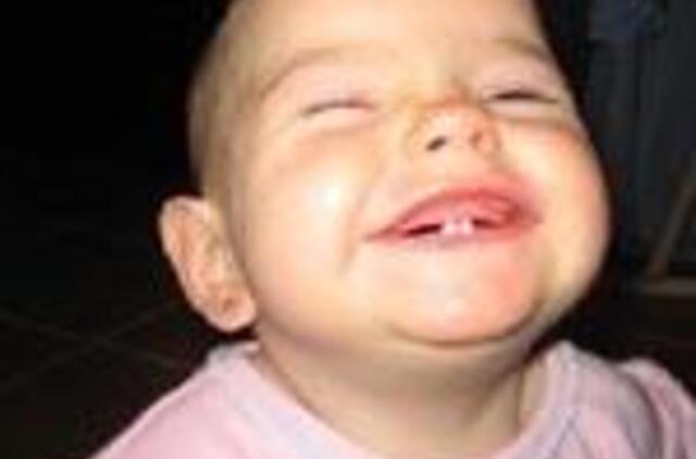 Pusmetis eilėje pas ortodontą - normalu 