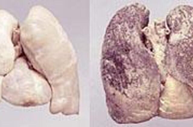 Kova su rūkymu: reikia naujų ginklų