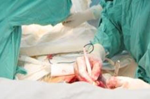 Amerikietei išoperuotas 64 kg svėręs auglys