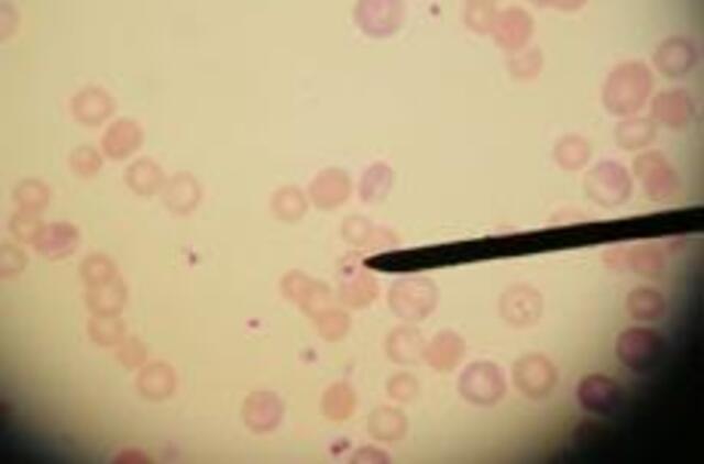 Kazachstane nuo juodligės mirė 38 metų vyras