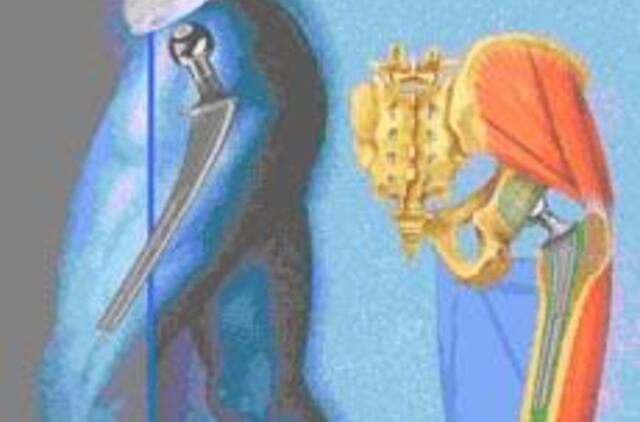 Ligoniai skundžiasi ilgomis endoprotezavimo laukiančiųjų eilėmis